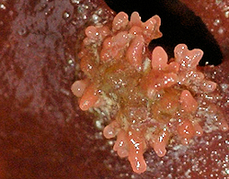 trs petites algues parasites