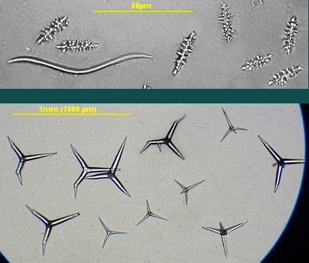 Dercitus bucklandi