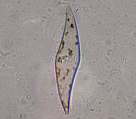Pleurosigma angulatum