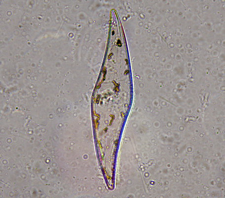 Pleurosigma angulatum