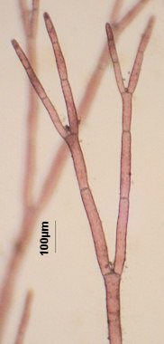 Anotrichium furcellatum