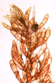 Callithamnion tetragonum