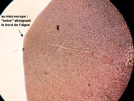 Erythroglossum laciniatum