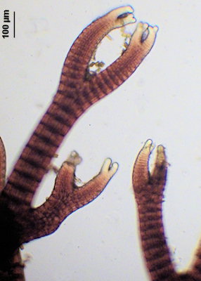 Vertebrata lanosa