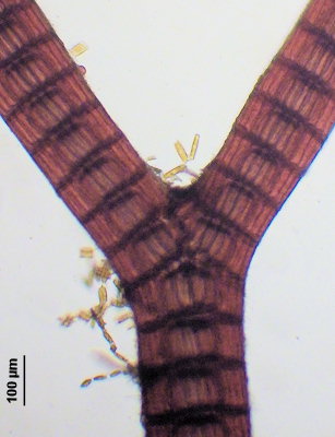 Vertebrata lanosa