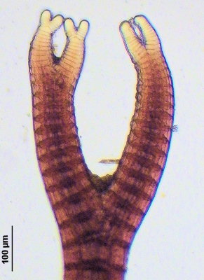 Vertebrata lanosa