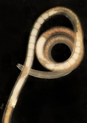 Nematoda